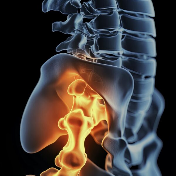 photo of sacroiliac joint v Job ID: b cdd e eb bdbd